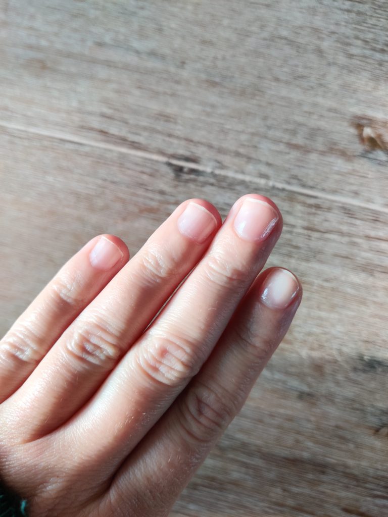 Résultats vitamines à mâcher Hairburst sur les ongles au bout d'une semaine